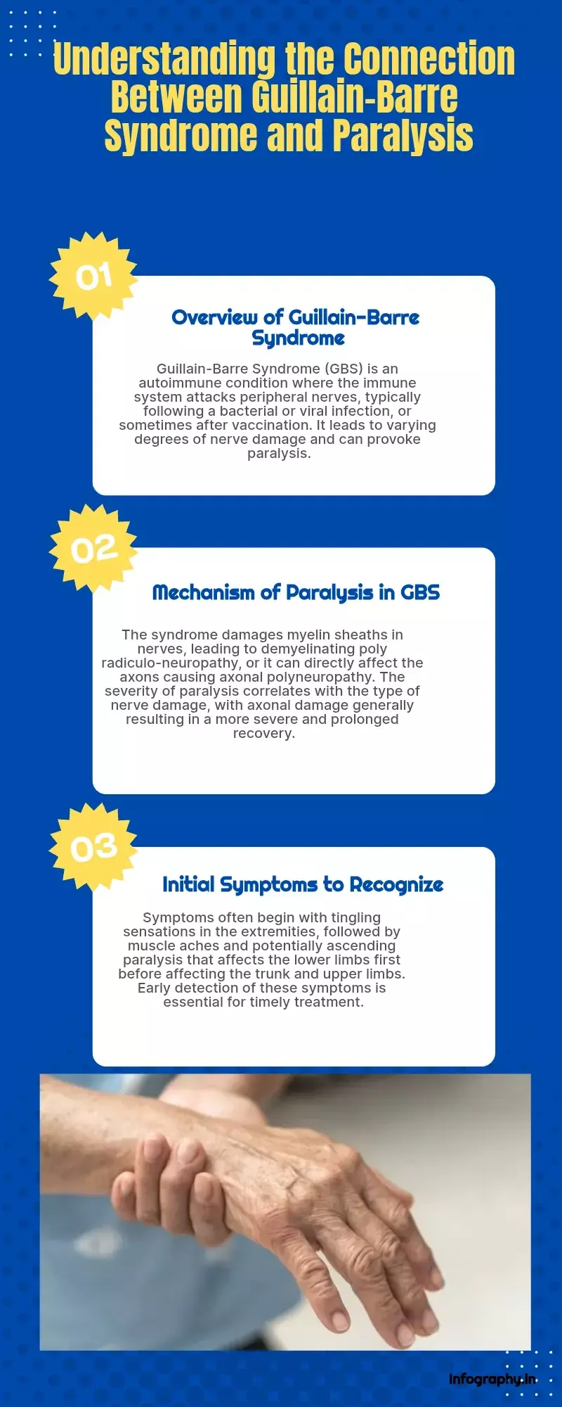 Guillain-Barre Syndrome and paralysis: Whats the connection?