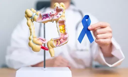 Colorectal cancer and smoking: Surgeon explains link, prevention tips